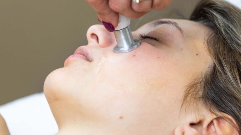 Qual è il miglior macchinario per offrire un trattamento anti rughe?